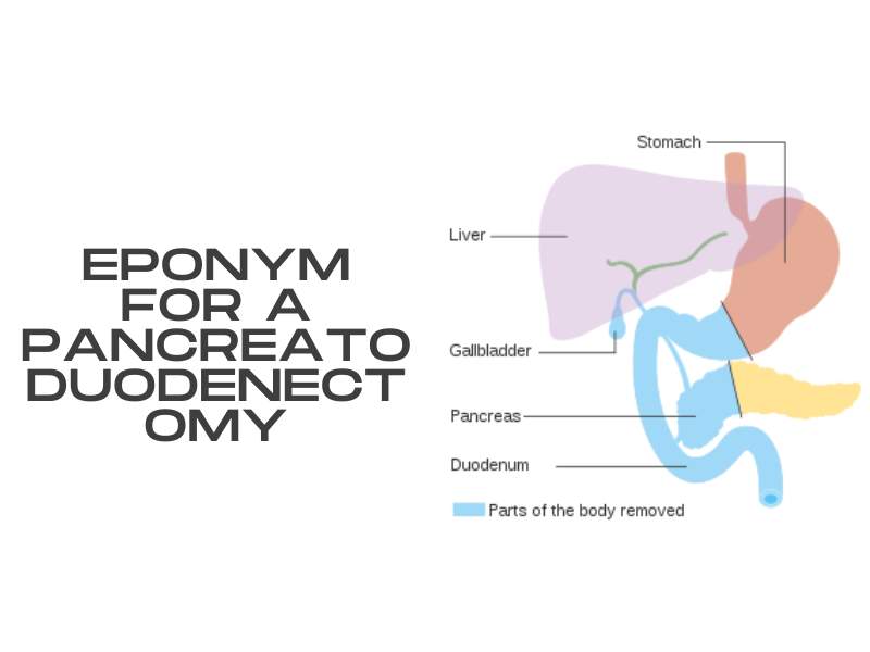Eponym for a Pancreatoduodenectomy